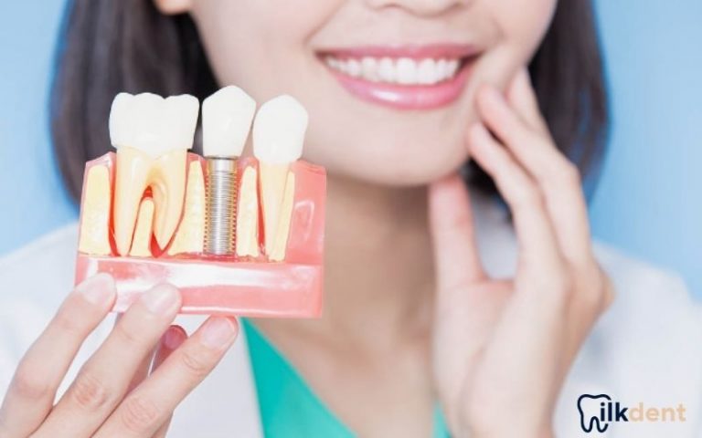 Bayrampaşa İmplant Diş ile Estetik ve Fonksiyonel Çözümler