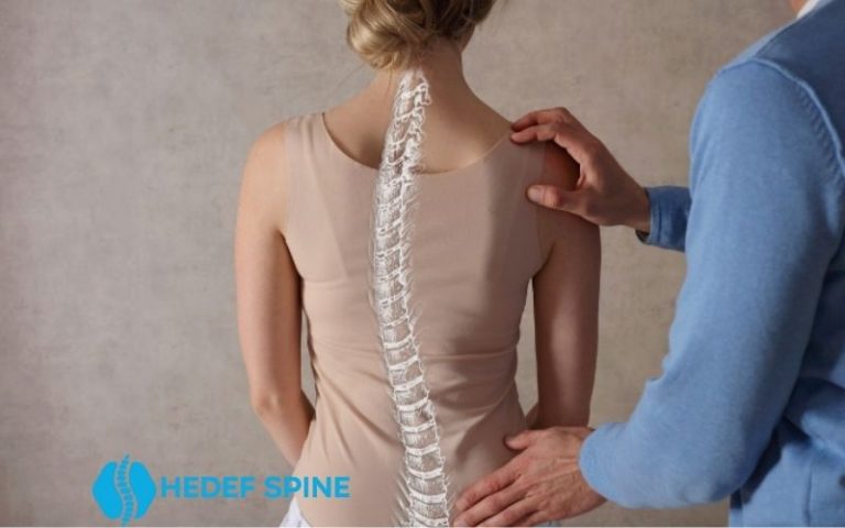 3d Skolyoz Korsesi ile Sağlıklı Bir Duruşa Kavuşun